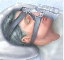 medical Anesthesia Breathing Ventilator Circuit use