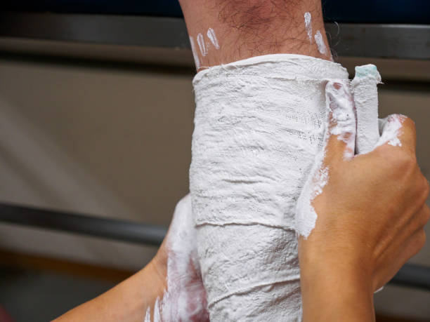 Plaster of Paris Bandage