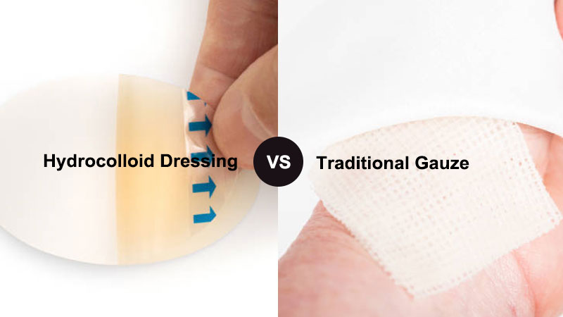 Hydrocolloid Dressing vs Traditional Gauze: Key Differences Hydrocolloid Dressing vs Traditional Gauze: Key Differences