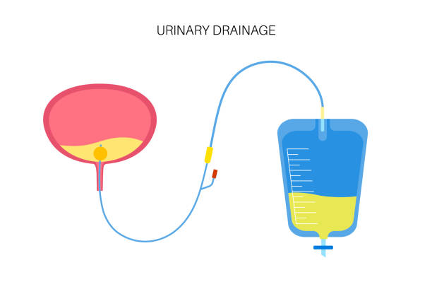 How Does a Foley Catheter Drainage Bag System Work