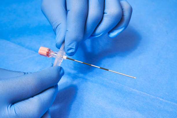 Epidural Needles Explained: Size, Length, and Key Features for Medical Procurement